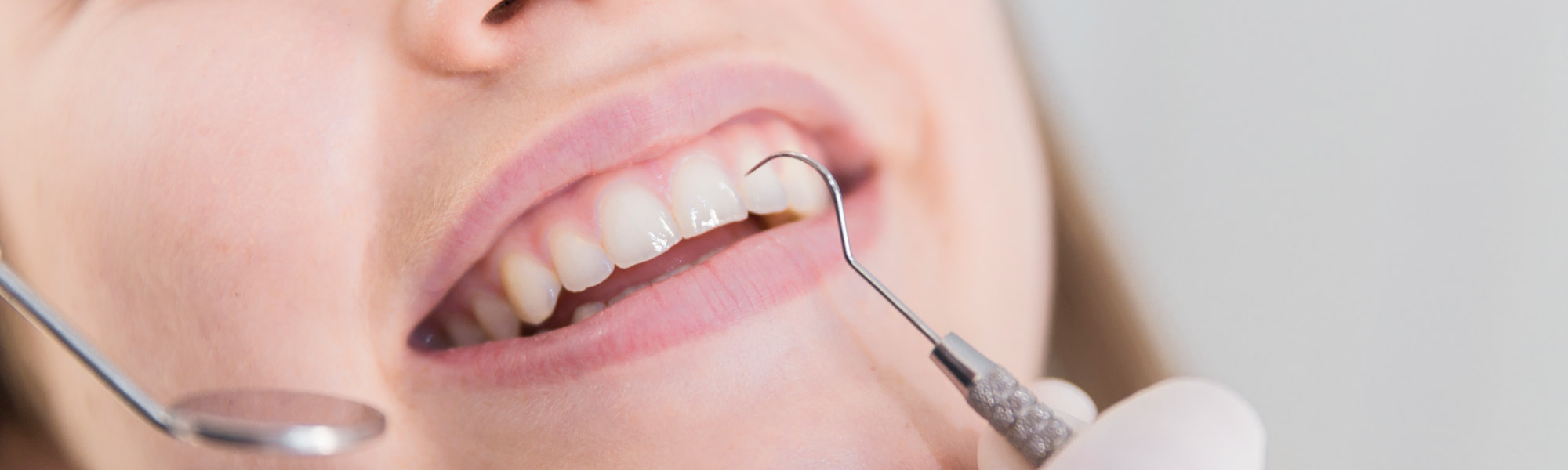 GlamSmileVeneersheader