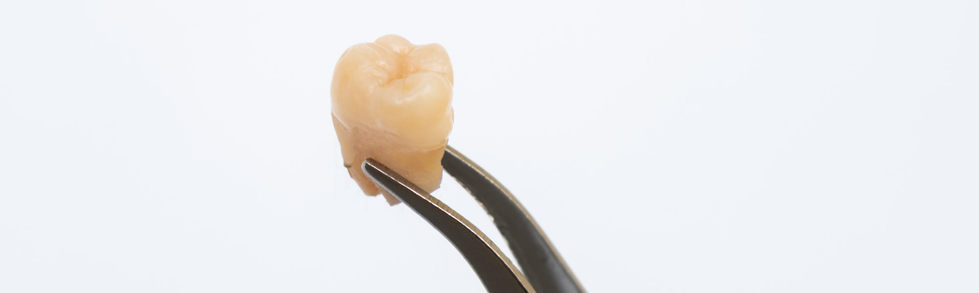 toothfeat